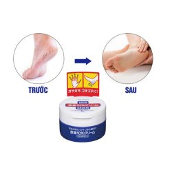 KEM TRỊ NƯT GÓT CHÂN TAY 100G